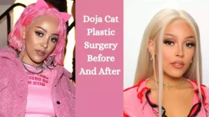 Doja Cat Plastic Surgery